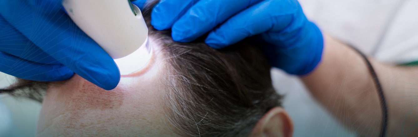 Hair Transplant in Turkey - All what you need to know